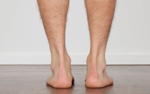 Fußschmerzen: Untersuchung der Beinachse