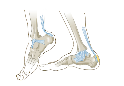 Anatomie des Fußes und der Ferse mit Schleimbeutel an der Achillessehne