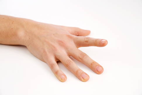 Fingermobilisation Zeigefinger