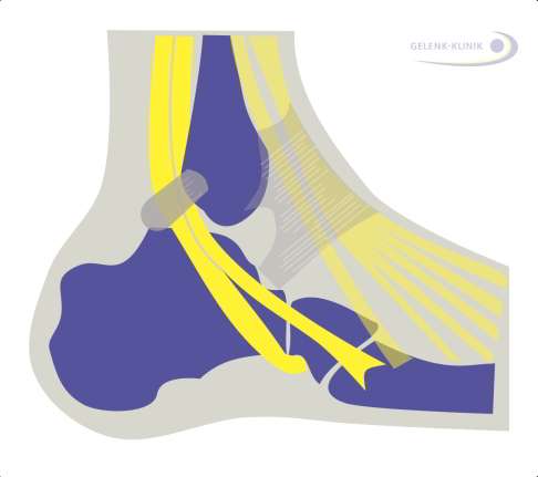 Anatomie der Peronealsehnen im Fuß