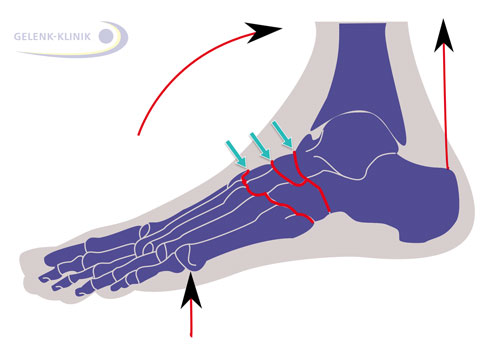 Anatomie des Fußes mit markierter Fußwurzel