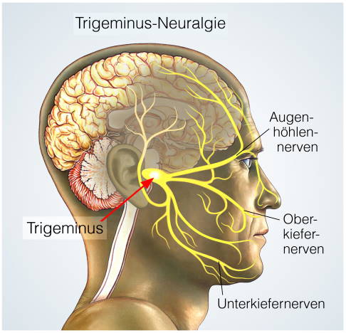 Anatomie des Trigeminusnervs mit drei Ästen