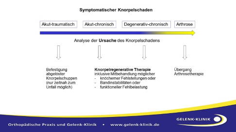Eine geeignete Therapie berücksichtigt immer auch die Ursache des Knorpelschadens. © Gelenk-Klinik Schaubild Knorpelschaden