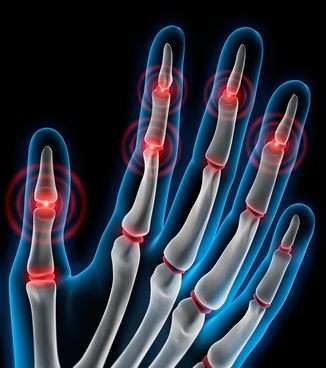 Häufige Auslöser für Gelenkschmerzen in den Fingern sind Gicht, Arthritis oder Arthrose. © peterschreiber.media, Fotolia Gelenkschmerzen in den Fingern