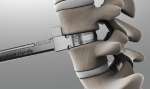 Nach der Reinigung des Bandscheibenfachs wird durch ein spezielles Geraet die erforderliche Höhe der Bandscheibenprothese bestimmt