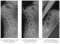 3 Röntgenbilder der HWS in verschiedener Position