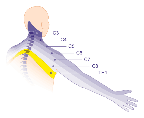 Darstellung der Armregionen, die von bestimmten Spinalnerven der Halswirbelsäule versorgt werden.