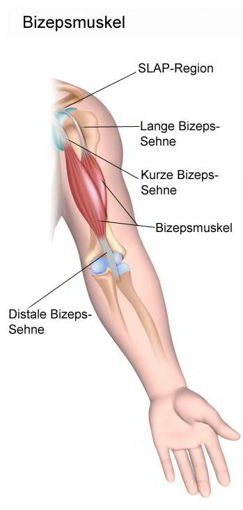 Lange, kurze und distale Bizepssehne