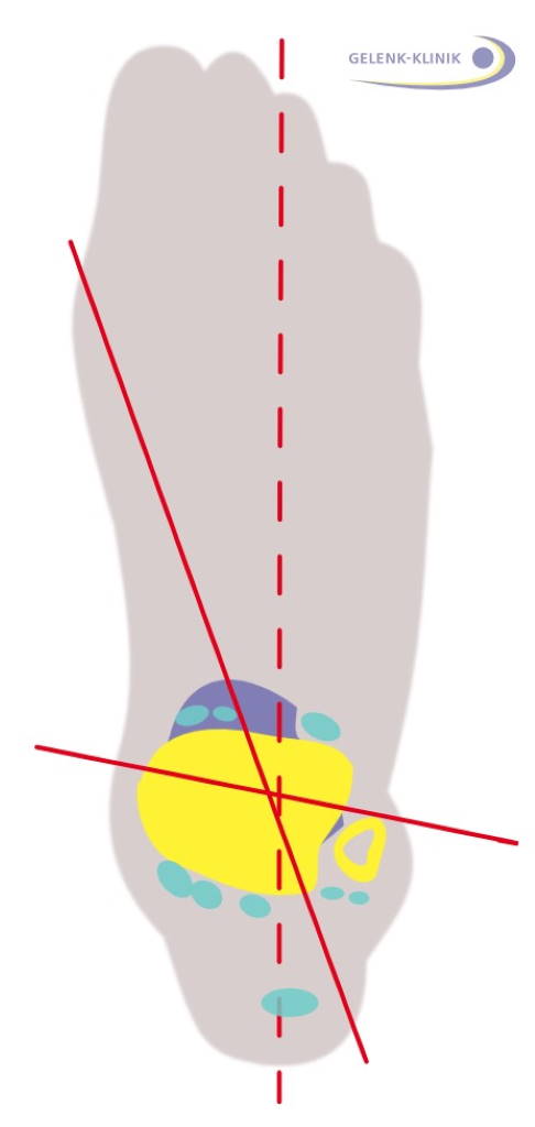 Bewegungsachsen an Fuß und Sprunggelenk