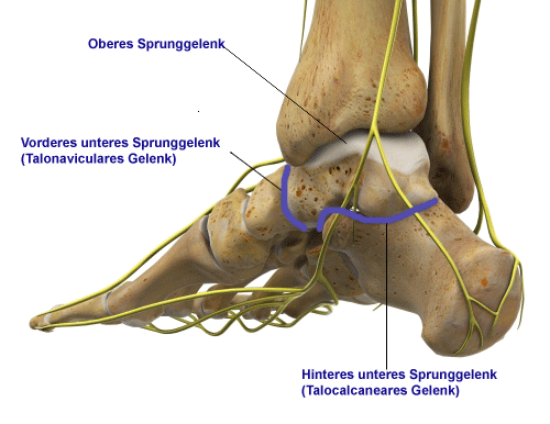 Blau eingezeichnet sind die beiden Gelenke des unteren Sprunggelenks, die bei einer Double-Arthrodese versteift werden.