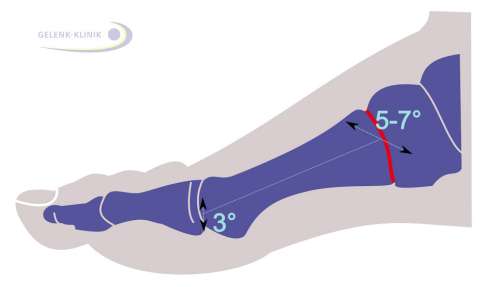 Beweglichkeit der Mittelfußgelenke