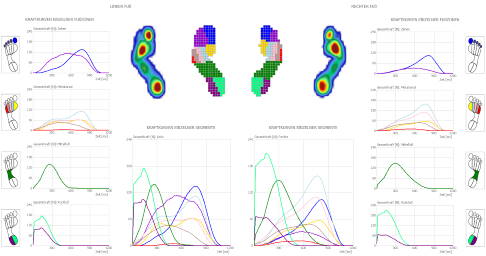 Auswertung Ganganalyse: Knick-Senkfuß