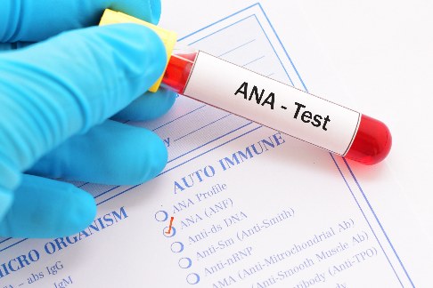 Ana Test