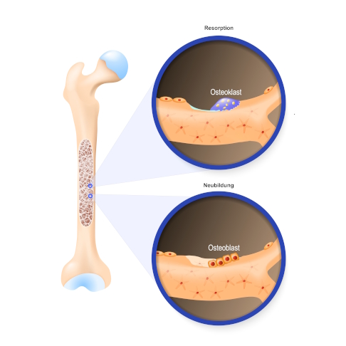 Knochenneubildung und -abbau durch Osteoblasten und Osteoklasten
