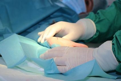 Für die endoskopische Operation des Karpaltunnelsyndroms (Neurolyse) sind nur minimale Hautschnitte notwendig. © U. J. Alexander, Fotolia Operation eines Karpaltunnelsyndroms