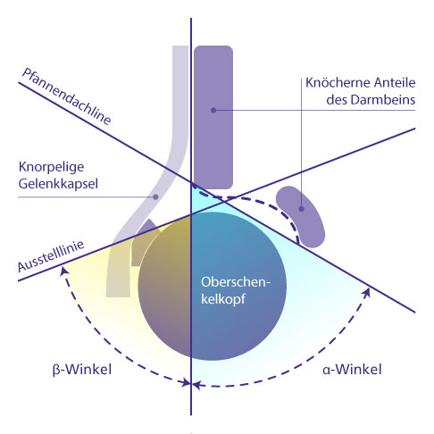 Lage der Winkel  α und β im Ultraschallbild beim Kind