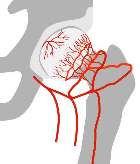 Im gesunden Zustand versorgen zahlreiche Gefäße das Knochengewebe des Oberschenkelkopfes mit Nährstoffen. © Gelenk-Klinik Oberschenkelkopf mit gesunder Durchblutung
