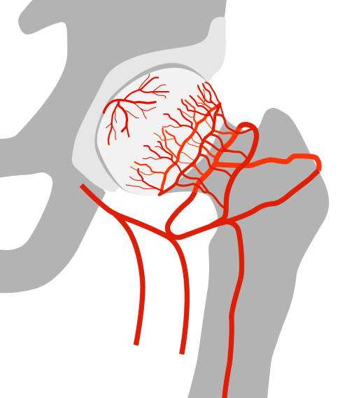 Oberschenkelkopf mit gesunder Durchblutung 