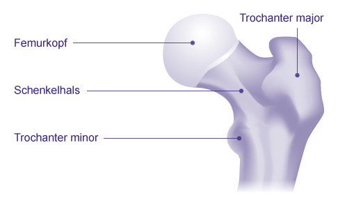 Anatomie: Trochanter major und Trochanter minor am Oberschenkelknochen (Femur)