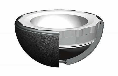 Die Gelenkpfanne der Hüftprothese besteht aus einer Metallkomponente die in das Acetabulum (Hüftpfanne) eingesetzt wird, und einem Inlay, das den Femurkopf aufnimmt. © Smith & Nephew Hüftpfanne: Acetabuläre Komponente der Hüftendoprothese