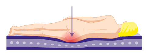 Druck auf die Hüfte beim Liegen auf der Seite