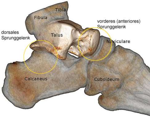 Sprunggelenk von der Seite: knöcherne Strukturen
