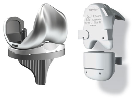 individual knee prosthesis - shape matching