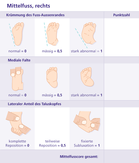 Erfassungsbogen nach Pirani für den Mittelfuß