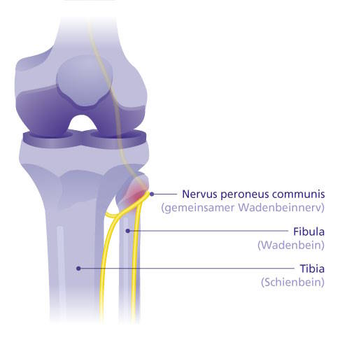 Verlauf des Nervus peroneus communis