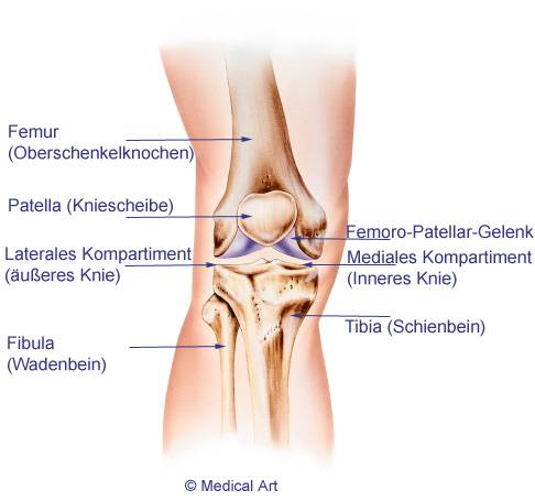 Anatomie des Kniegelenks: Kniearthrose kann lokal begrenzt in den einzelnen Kompartimenten des Kniegelenks auftreten, dem inneren Kniegelenk, dem äußeren Kniegelenk und dem retropatellaren (hinter der Kniescheibe gelegenen) Gelenk.