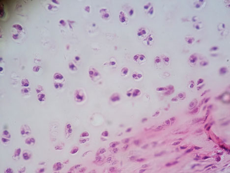 Mikroskopische Aufnahme von Knorpelzellen (Chrondrozyten)