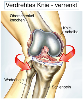 Kniescheibe knieschmerzen innen neben Kniescheibenschmerzen: Symptome,