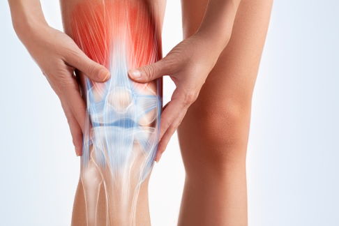 Knieschiene zur Behandlung der Gonarthrose (Arthrose des femoral