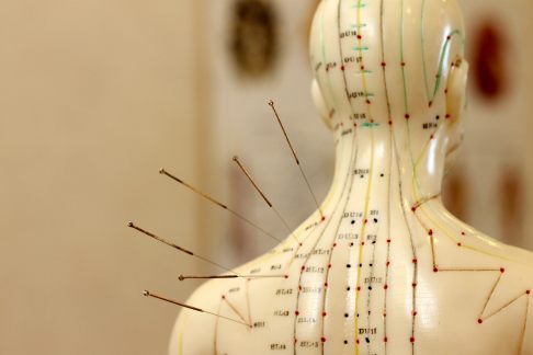 Akupunkturpunkte und Meridiane