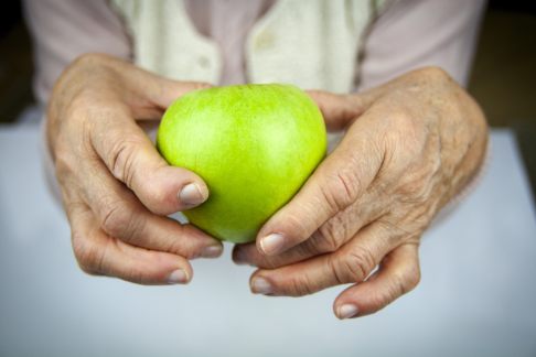 An Rheuma erkrankte Hand hält Apfel