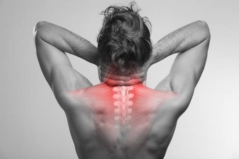 Nackenschmerzen aufgrund eines eingeklemmten Nervs