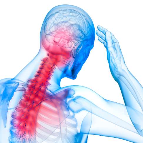 Nackenschmerzen entstehen häufig durch Muskelverspannungen im Bereich der Halswirbelsäule.