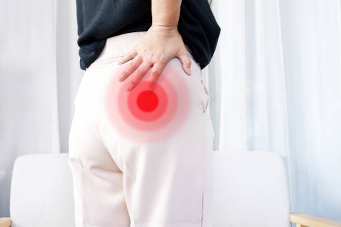 Frau mit Piriformis-Syndrom leidet an Schmerzen im unteren Rücken und im Gesäß.