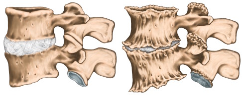 Abbildungen von Spondylophyten aus verschiedenen Perspektiven