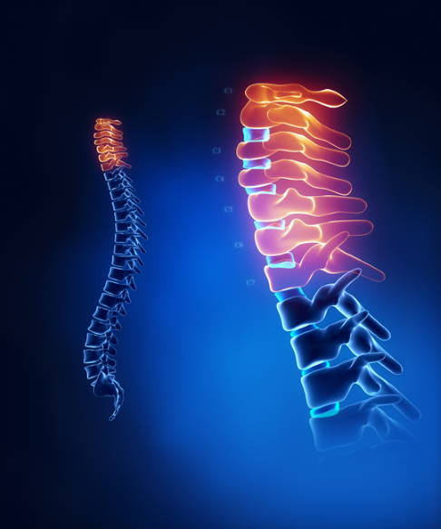 Anatomie: Halswirbelsäule mit 7 Halswirbeln