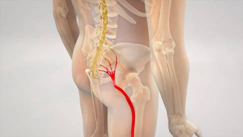 Anatomie: Verlauf des Ischiasnervs