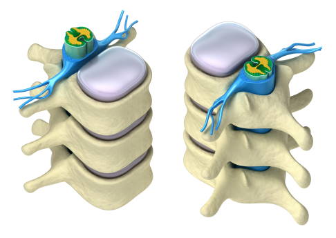 Anatomie der Wirbelsäule im Querschnitt mit Sicht auf den Spinalkanal